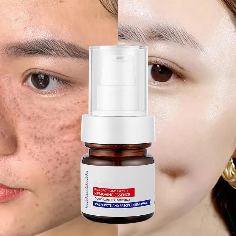Vitamin C Whitening Freckles ESSENCE：Dark spots disappear, blemishes fade, and skin becomes radiant!
