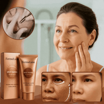 FerméLuxe Peel-Off Face Mask | Removes Sunspots & Pigmentation in Just 7 Days!