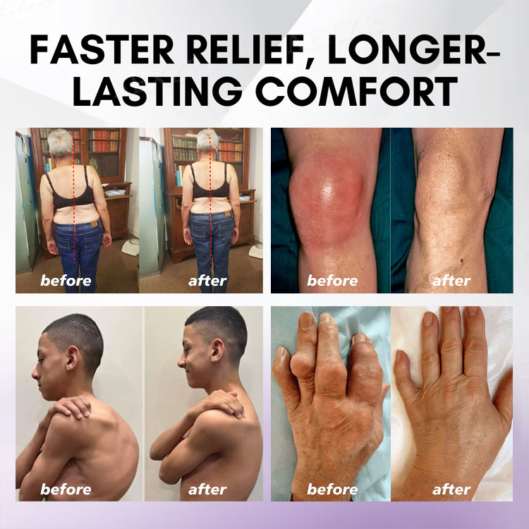 ⏰Black Friday Limited-Time Special Offer: BUY 1 GET 1 FREE🔥Lovilds™ Turmeric & Emu Oil Arthritis Soothing Pain Relief Massage Gel 👨‍⚕️ American Osteopathic Association (AOA) Approved