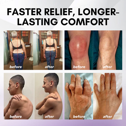 ⏰Black Friday Limited-Time Special Offer: BUY 1 GET 1 FREE🔥Lovilds™ Turmeric & Emu Oil Arthritis Soothing Pain Relief Massage Gel 👨‍⚕️ American Osteopathic Association (AOA) Approved