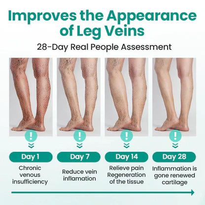 LOVILD® LegRenew Varicose Veins Patch