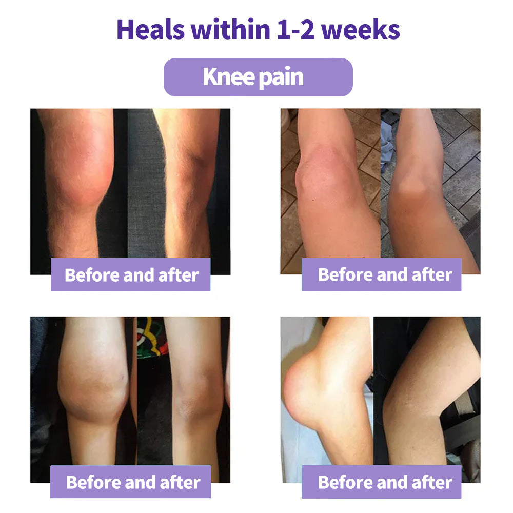 ⏰Black Friday Limited-Time Special Offer: BUY 1 GET 1 FREE🔥Lovilds™ Turmeric & Emu Oil Arthritis Soothing Pain Relief Massage Gel 👨‍⚕️ American Osteopathic Association (AOA) Approved