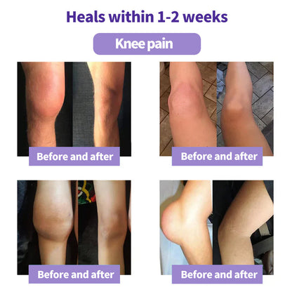 ⏰Black Friday Limited-Time Special Offer: BUY 1 GET 1 FREE🔥Lovilds™ Turmeric & Emu Oil Arthritis Soothing Pain Relief Massage Gel 👨‍⚕️ American Osteopathic Association (AOA) Approved