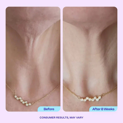 Miracle Neck Cream for "Tech Neck" & "Turkey Neck", Visibly Firmer, Smoother-Looking Skin in 4–8 Weeks