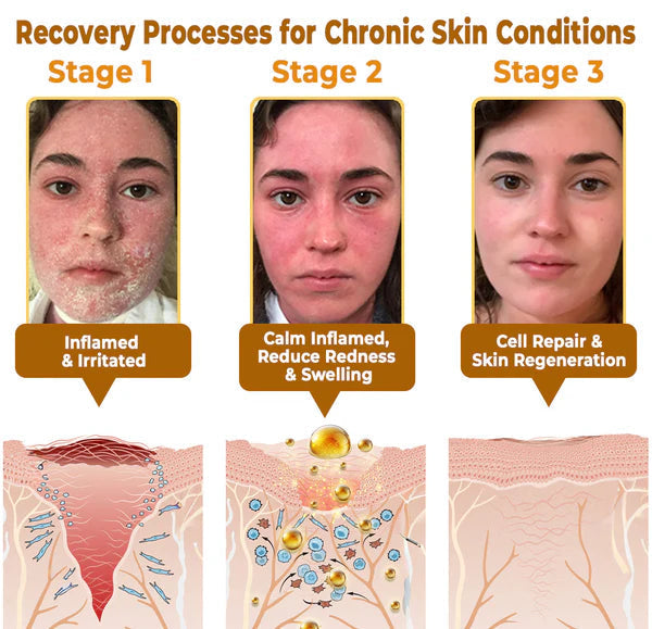 The "Forbidden" Natural Discovery That Erases Years of Skin Damage & Ends The Daily Battle With Psoriasis, Wrinkles & Chronic Skin Conditions